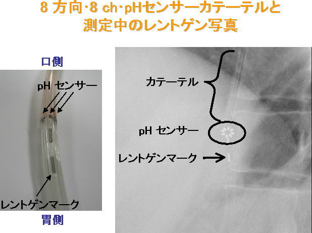 8 方向･8 ch･pHセンサーカテーテルと測定中のレントゲン写真