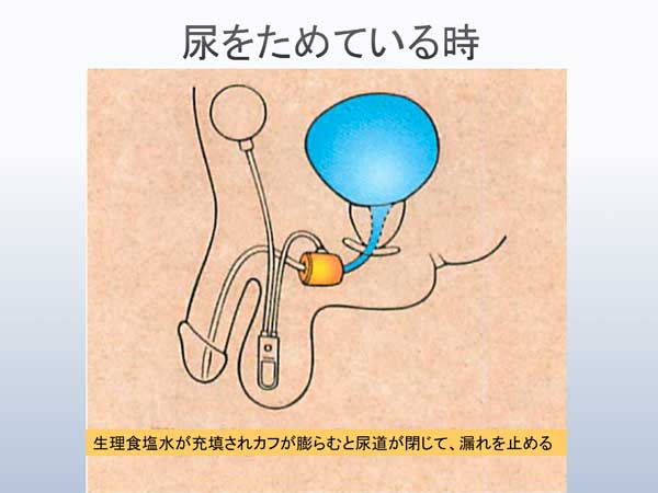 括約筋 