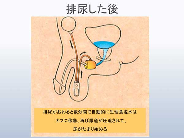 排尿した後