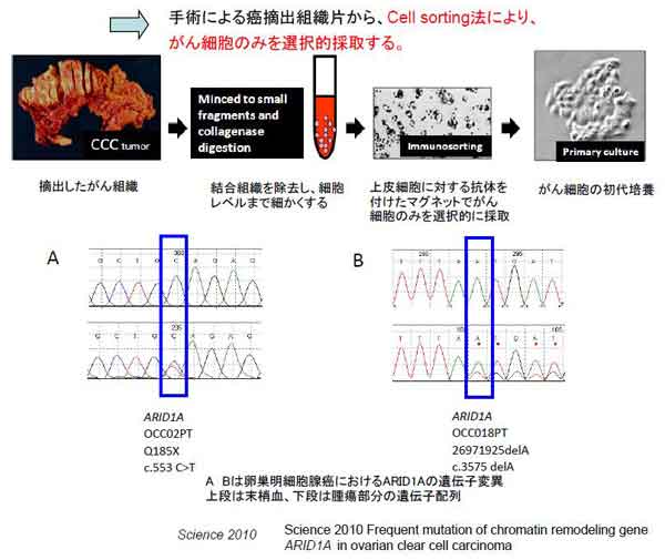 手術による癌摘出組織片から、Cell sorting法により、がん細胞のみを選択的採取する。