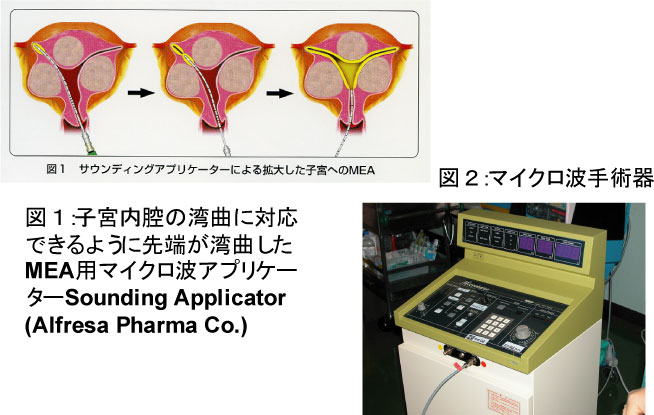 MEAの実際