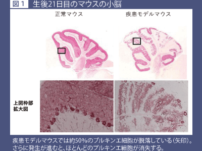 プルキンエ細胞