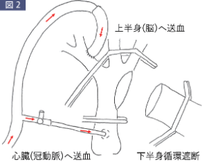 図2
