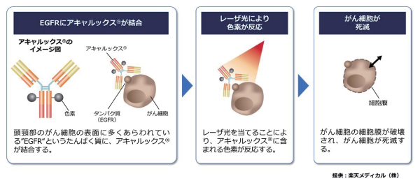 治療模式図