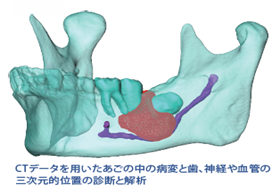 顎3Dイメージ